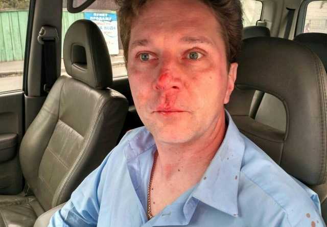 Сломанный нос и сотрясение мозга: В Киеве снова избили врача, рассказавшего о поборах в больнице