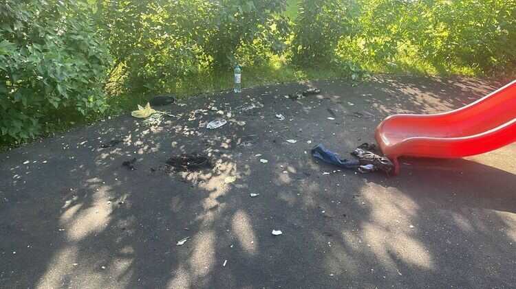 У Москві підліток на дитячому майданчику облив бензином та підпалив свого друга