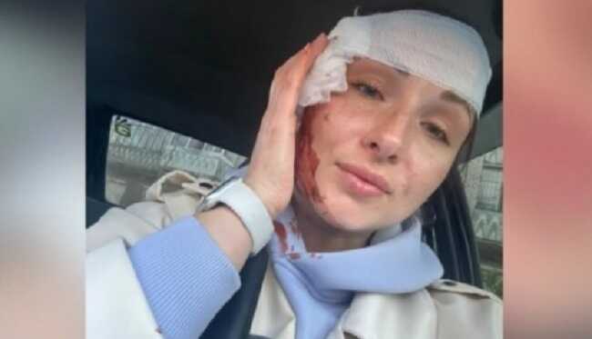 Журналісти отримали поранення під час повторного удару по Запоріжжю