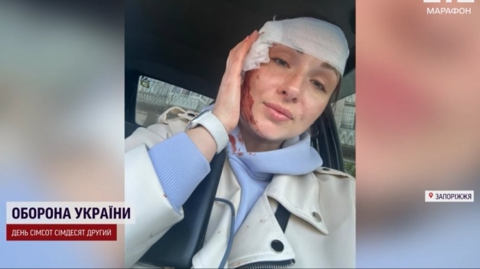 Ворог повторно вдарив по Запоріжжю: поранено журналістів (відео) xdideeieuiktant