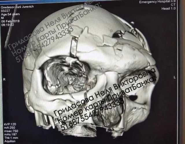 В Каменском жестоко избит известный хирург: разбита половина черепа