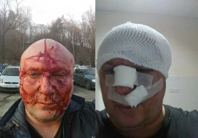 Перелом черепа: догхантера Святогора после суда жестоко избили в Киеве